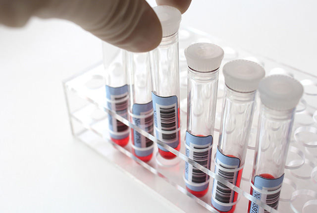 血液が入ったシリンジ