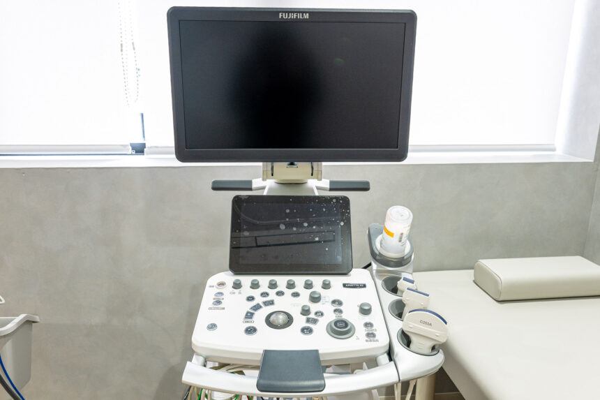 超音波診断装置