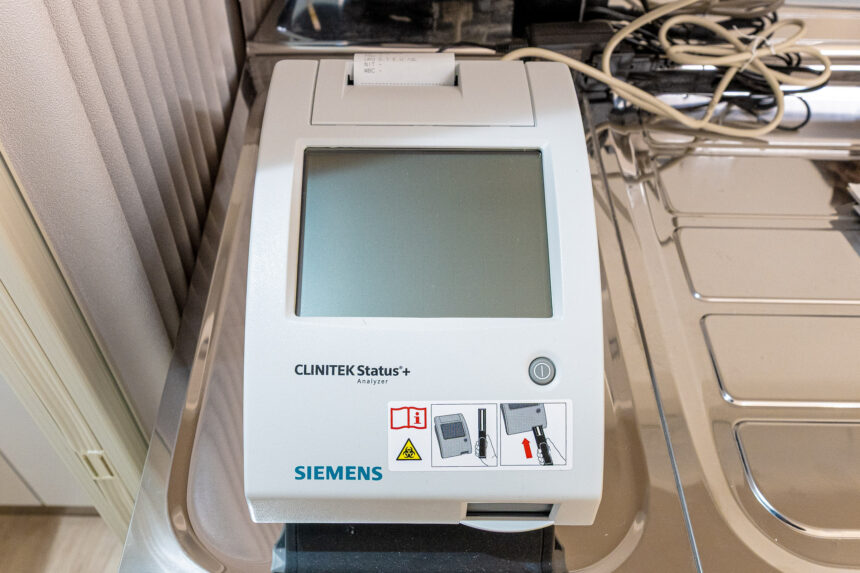 小型尿分析装置